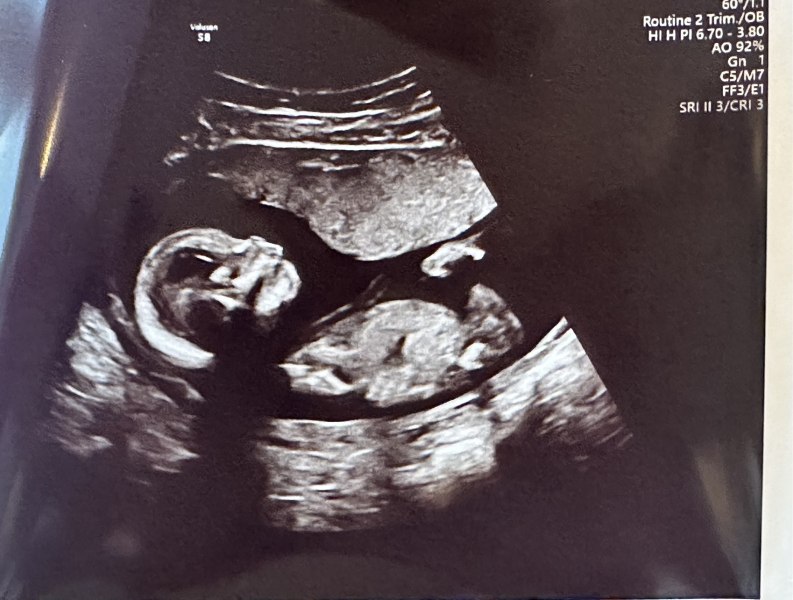 Due March 2025 thread 2
