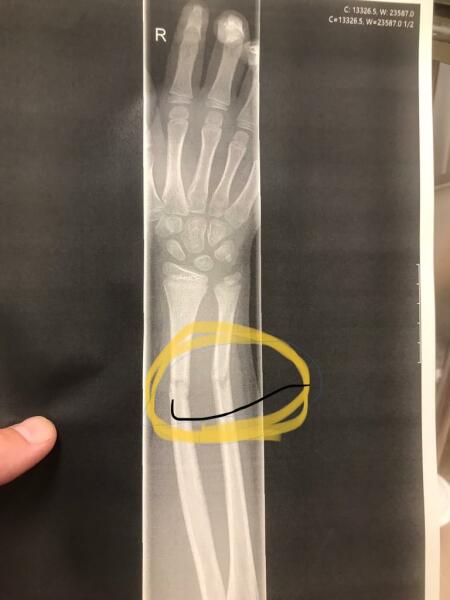 Persuade me not to get a trampoline?