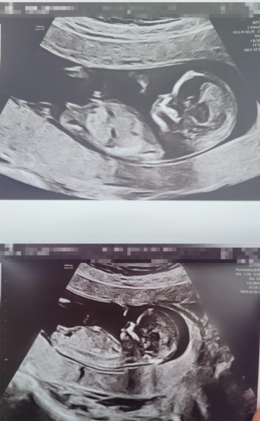 Boy or Girl?