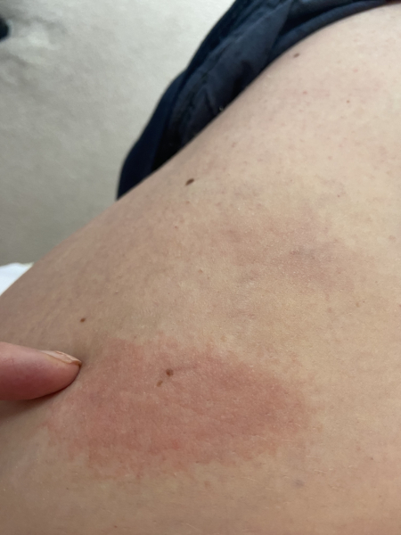 Continuing Mounjaro... Part 21