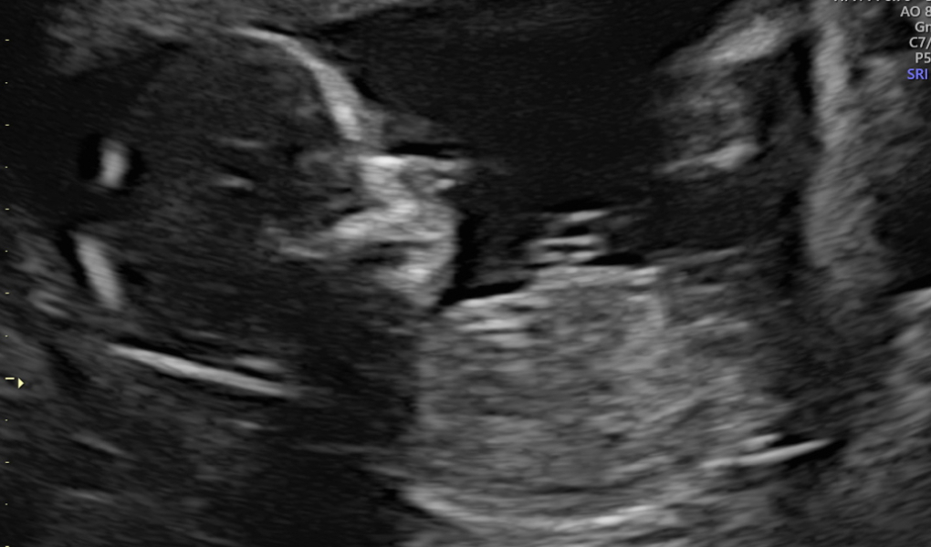 Due February 2025 - Thread 3