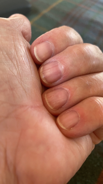 Nails