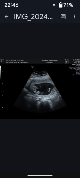 Gender of scan images