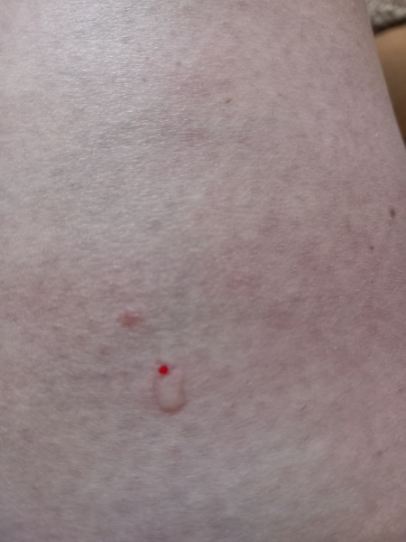 Mounjaro September Support