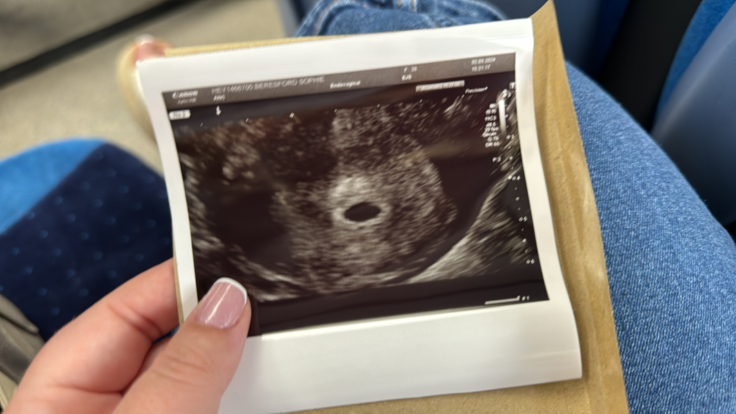 Faint yolk sac 5 days 3