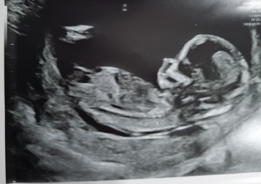 Gender have girl before