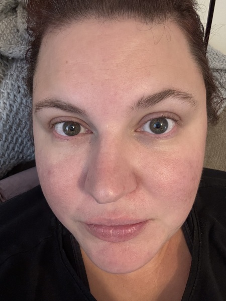 Wondering about my skin prescription