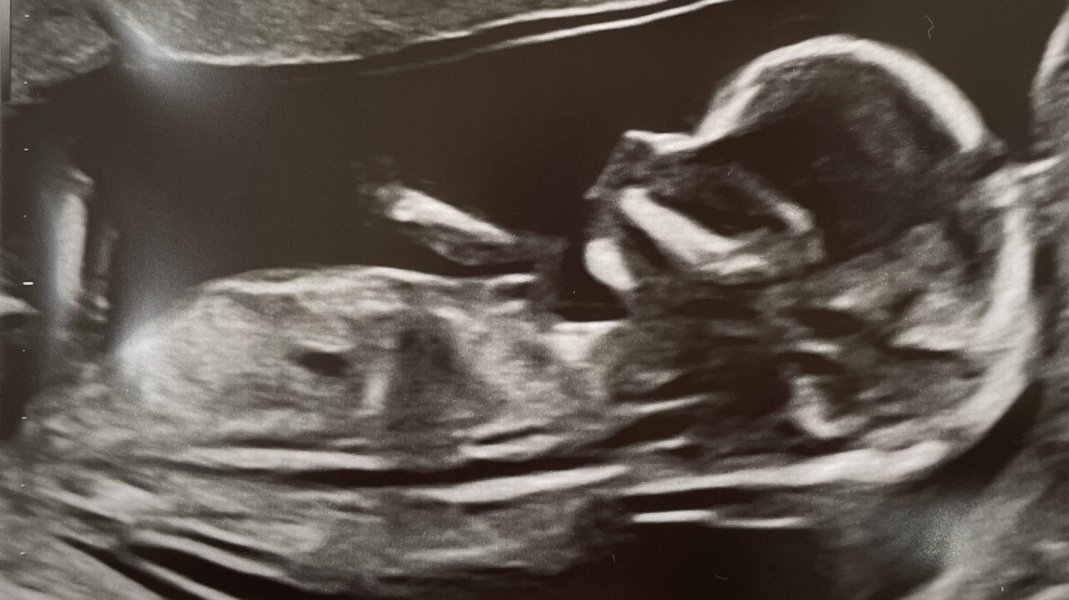 Boy or girl