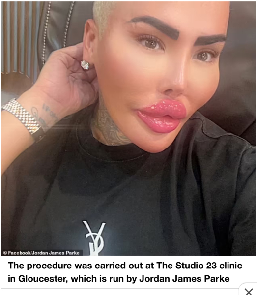 To think that 5 children growing up motherless because their Mum wanted cosmetic surgery is absolutely tragic *edited by MNHQ