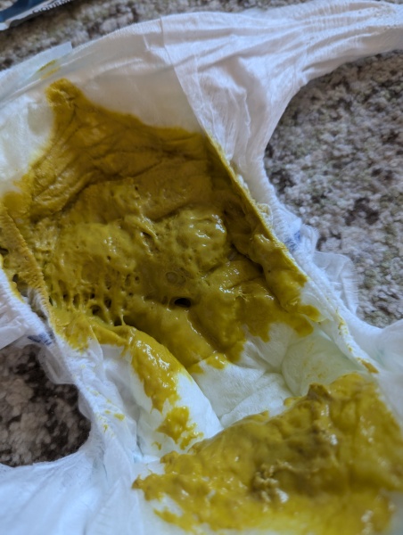 Is this a normal bowel movement for baby?