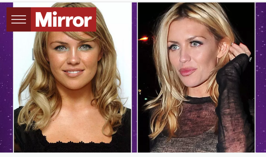 Abbey Clancy