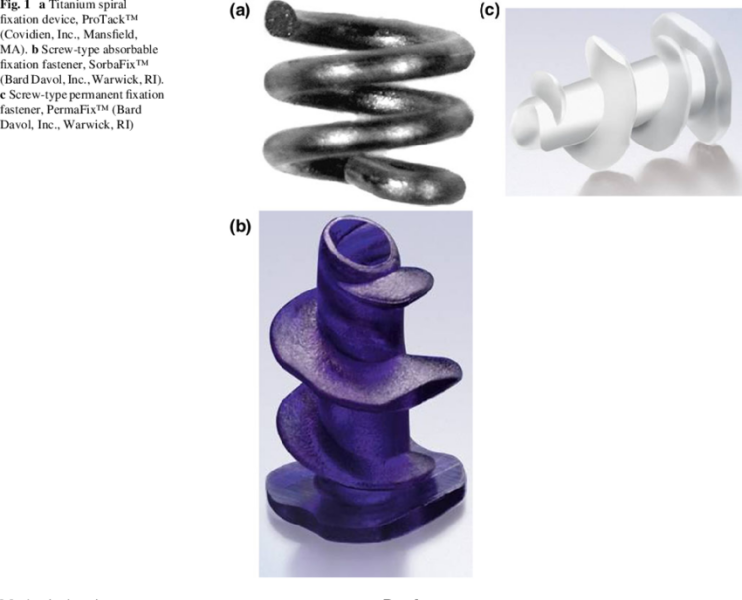 Can anyone identify this thing that came out of my DIL