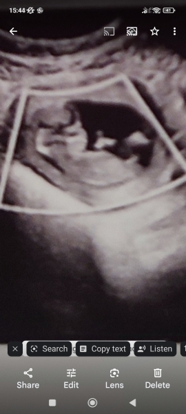 Nub theory - Girl or Boy?
