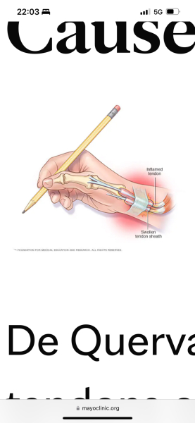 Help severe thumb pain