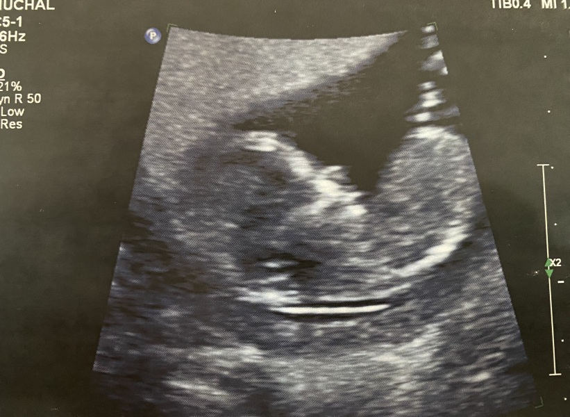 Girl or Boy predictions (13 weeks)