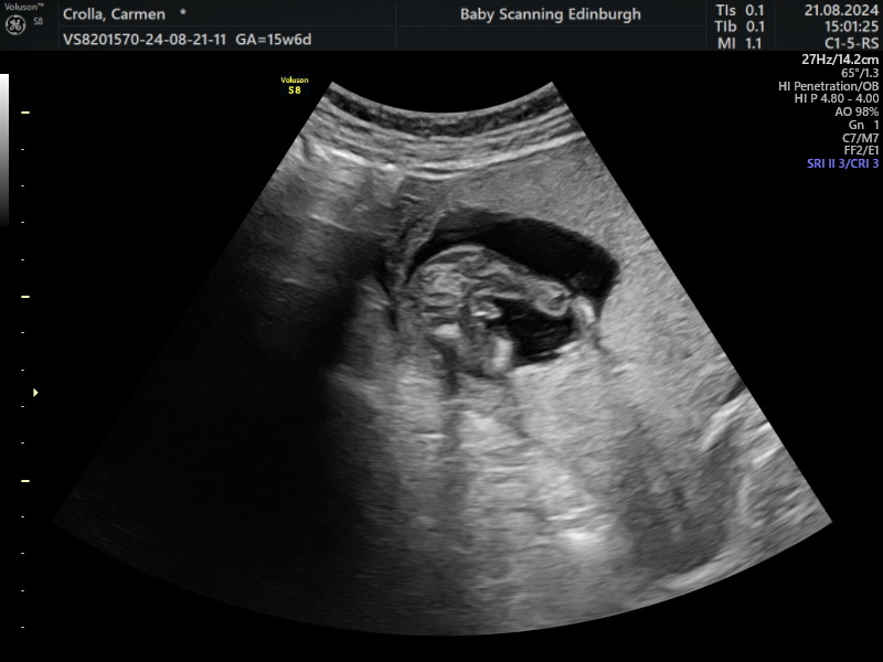 16 week gender reveal images