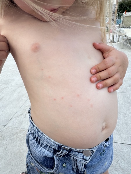 Toddler random spots