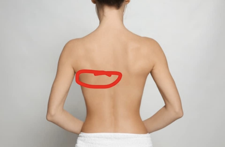 Does this back pain sound like poor posture?