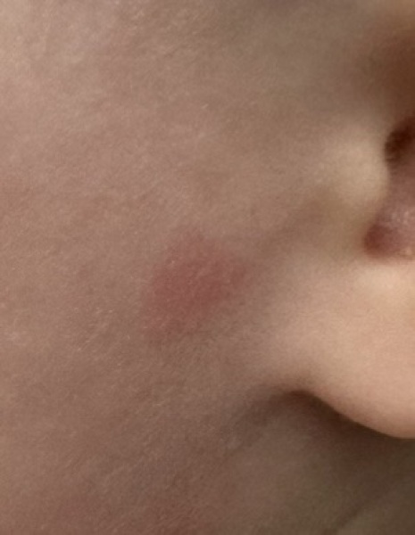 Random red patches