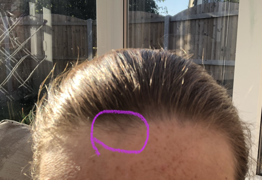 To cut the front piece of my hair off? With pics