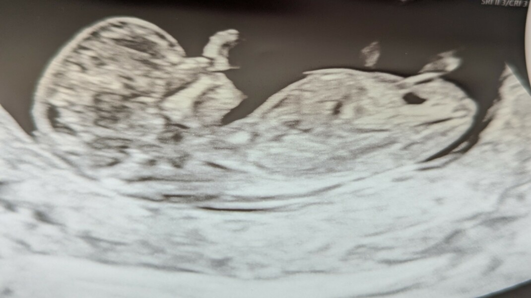 Guess my baby's gender