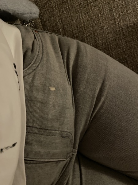 Splashed bleach on my new jeans. Can I get it out?
