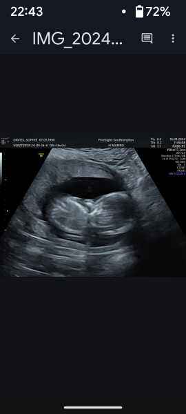 Gender of scan images