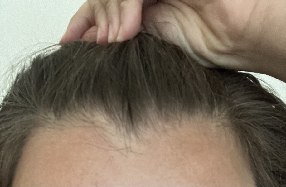 To cut the front piece of my hair off? With pics