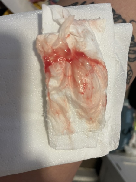 Bloody show TMI******