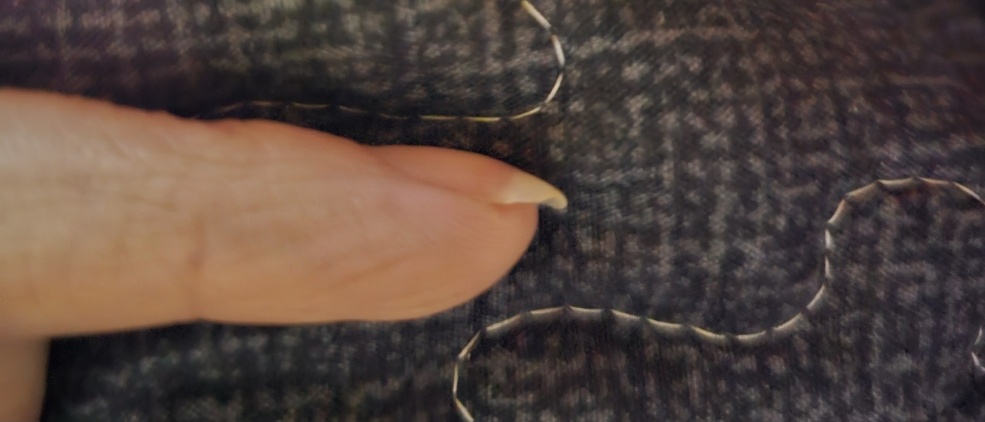 Why's my nail like this