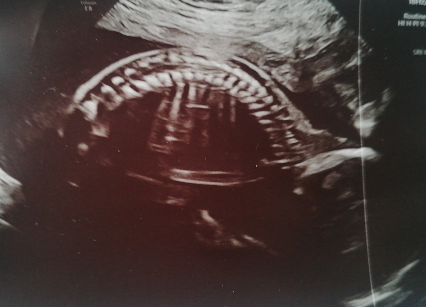Due February 2025 - Thread 3