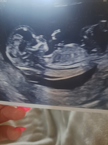 Guess my babys sex