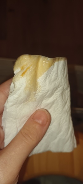 Different discharge advice