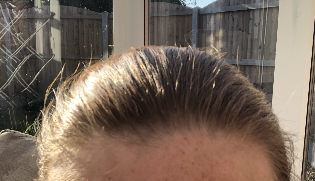 To cut the front piece of my hair off? With pics