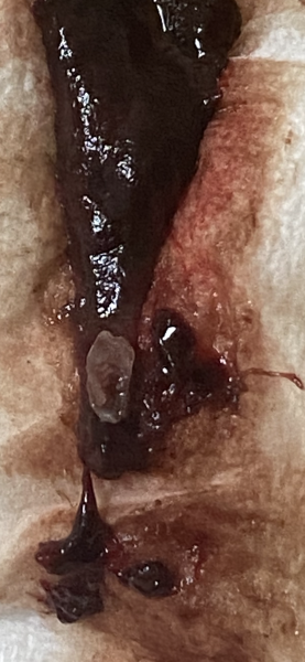 Could these be miscarriages?