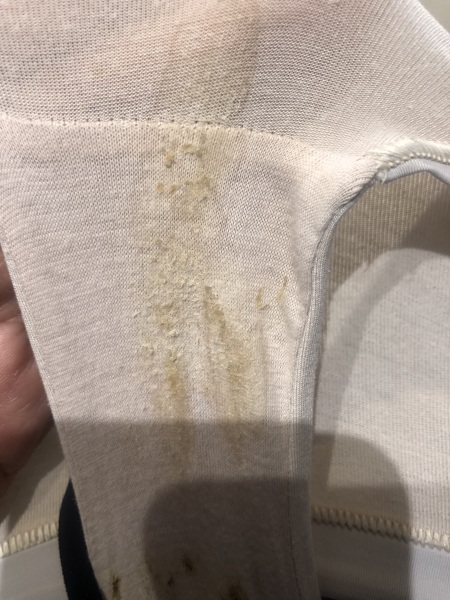 Vaginal discharge