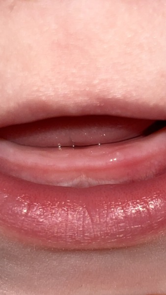 More sick..teething?