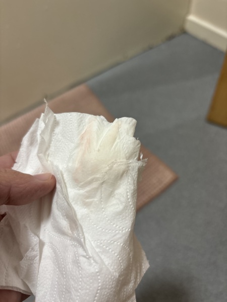 Bleeding 10 weeks + 5