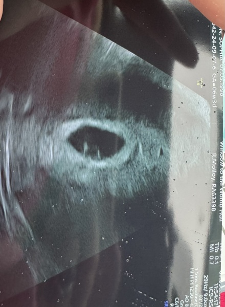 Does anyone know what I'm looking at?