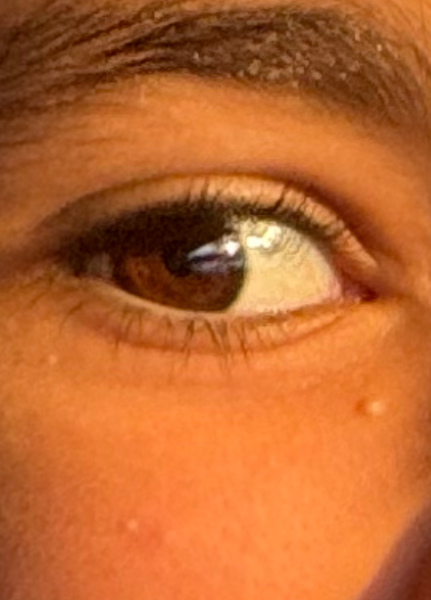 What do you think these spots on my 11yo are?