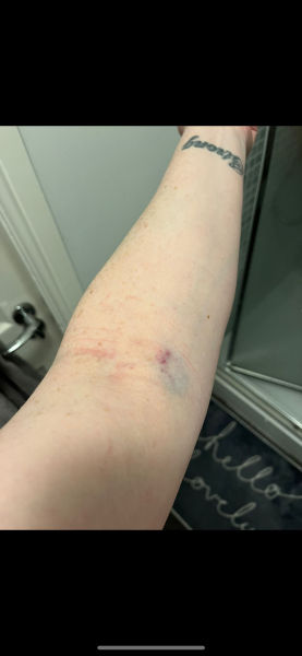 Been for a blood test, what has she done! Photo attached