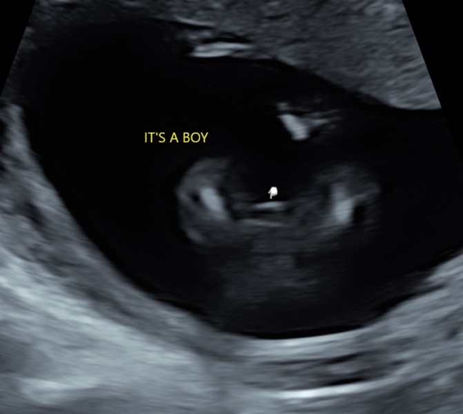 Potty shot confirmation?