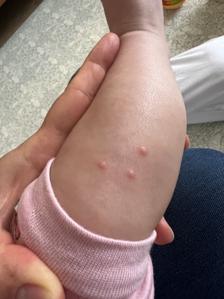 Any idea what these spots on my 6 month old’s leg are?