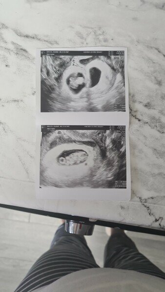 Miracle IVF Cyprus by Dr. Firdevs