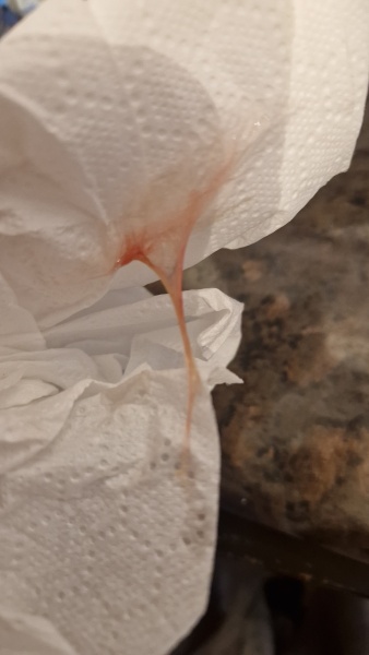 Discarge before my period