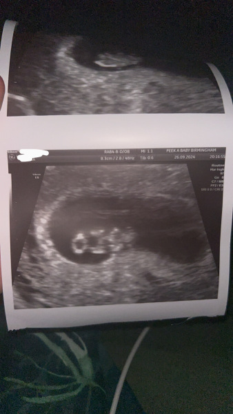 Waiting for the 12 week scan