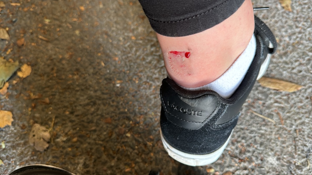 Please help with injury.