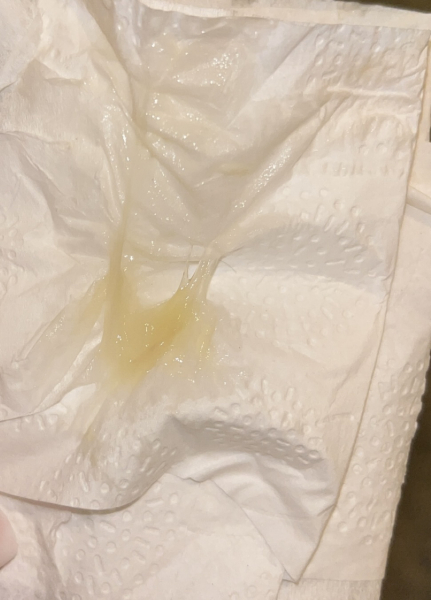 Mucas plug (with picture)