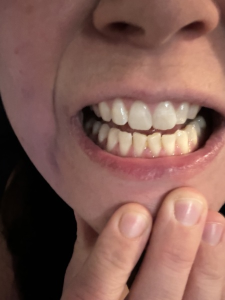 Teeth