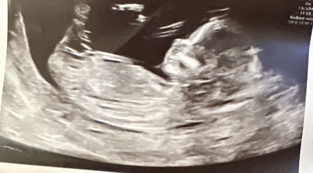 Girl or boy?